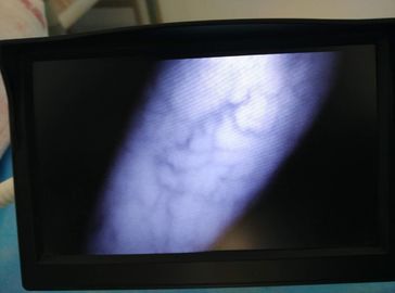 Отсутствие фокуса прибора детектора вены оборудований внимательности лазера младенческого регулируемого