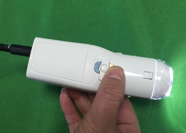 Colposcope цифров влагалищной камеры электронный для того чтобы найти заболевание Cervix Eealier