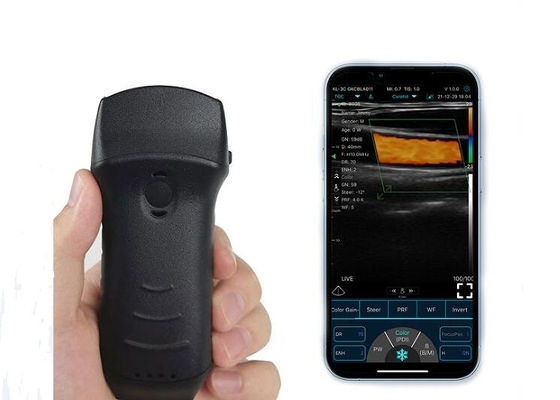 305мм Wifi портативный ультразвуковой сканер мочевого пузыря выпуклый+линейный+сердечный зонд
