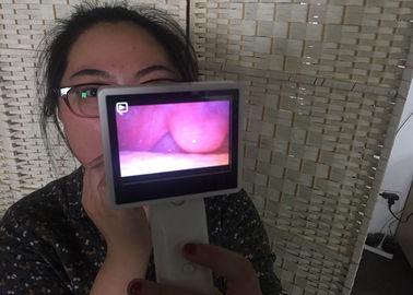 Отоскопе цифров видеокамеры Рхиноскопы ЭНТ эндоскопии медицинский для носа проверяя с экраном ЛКД