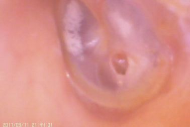 Видео- Отоскопе цифров амера к уха и носа для прокалывания Тымпаник мембраны