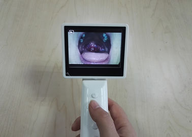 Офтальмоскоп Отоскопе соединения УСБ или ВИФИ Хандхэльд видео- установил 3 объектива опционный