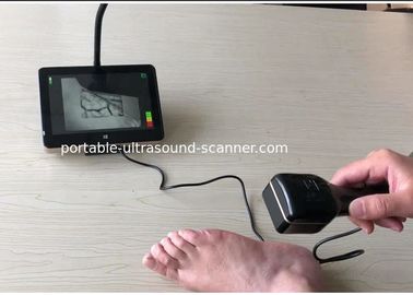 Телезритель вены медицинского локатора вены системы просмотра вены ультракрасного Handheld карманный с светом СИД