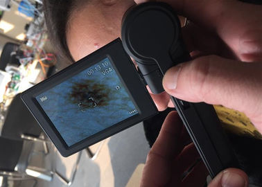 Видео- контролер поверхности кожи УСБ анализатора кожи цифров микроскопа Дерматоскопе с монитором 3 дюймов