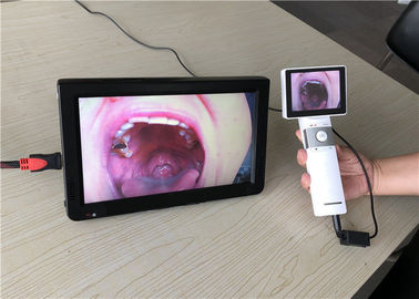 Камера Дерматоскопе горла портативного офтальмоскопа Отоскопе видео- с выходом карты СД для клиники