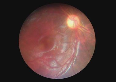 Эндоскопе Дерматоскопе цифров Отоскопе офтальмической камеры горла оптического оборудования видео- с 2 миллиона пикселами