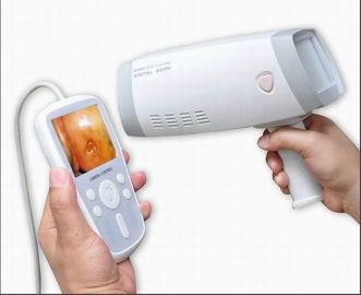 Colposcope камеры цифров Handheld цервикальный для Gynecology для того чтобы проверить Cervix с 80,0000 сигналом разрешения 1~128 пикселов
