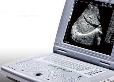 Портативная машина ультразвука для веса 2.2кгс блока развертки ультразвука беременности портативного только