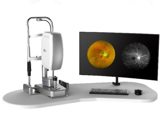 Оборудование камеры Fundus сканирования лазера профессиональное офтальмическое с Fundus отображая размер зрачка FOV 160° минимальный 2 mm