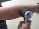 Подгонянное здравоохранение Handheld медицинское Dermatoscope для осмотра кожи