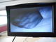 Васкулярные изображения показывая вены в искателе вены экрана ультракрасном для нюнь и докторов