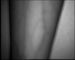 Васкулярные изображения показывая вены в искателе вены экрана ультракрасном для нюнь и докторов