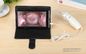 Colposcope цифров влагалищной камеры Cervix камеры электронный видео- для осмотра Gyneclogy с устранимым расширителем