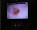Перезаряжаемые портативный офтальмоскоп Дерматоскопе Отоскопе с выходом карты СД
