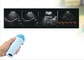 Ручной сканер мочевого пузыря портативный микро выпуклый ультразвуковой датчик ветеринарная беременность