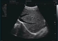 Ультразвук Доплера в частоте 12МХз зонда ультразвука Доплера дома беременности