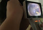 Осмотр цифров ЭНТ Отоскопе цифров Эндоскопе видео- полный с Отоскопе УСБ выхода карты СД