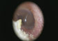 Отоскопе УСБ КМОС 1920 кс 1080 пикселов умный медицинский видео- для кожи уха и общего воображения