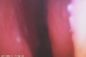 Видео- Отоскопе цифров амера к уха и носа для прокалывания Тымпаник мембраны