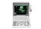 Блока развертки ультразвука ноутбука цифров оборудование БИО 3000Дж портативного мобильного медицинское с экраном СИД 1,12 дюймов