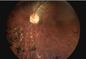 Камера Fundus офтальмоскопа H.264 цифров осмотра