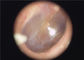 Эндоскопе Отоскопе устранимого Эармуфф доступный медицинский портативный для горла глаза уха