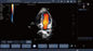 Блок развертки ультразвука Допплер цвета языка Мутил фетальный с микро- выпуклым зондом