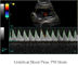 Блок развертки ультразвука диагностического прибора Ипад ультразвуковой портативный с хранением изображения 500Г