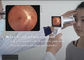 Телемедицина в угле взгляда камеры Fundus цифров офтальмологии программного обеспечения Wifi 45 градусов опционного для отчета