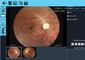 Камера Fundus цифров офтальмического визуализирования портативная Не-Mydriatic включает 7 внутренних пунктов фиксирования