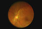 Телемедицины камеры Fundus офтальмоскопа пикселы разрешения 1280 x 960 портативной Handheld доступные видео-