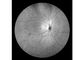 Оборудование камеры Fundus сканирования лазера профессиональное офтальмическое с Fundus отображая размер зрачка FOV 160° минимальный 2 mm