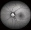 Confocal камера Fundus Opthalmoscope цифров сетчатки с FOV 15°, 30°, размером 1024*1024 изображения 60°
