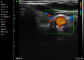 Цвета блока развертки ультразвука Ipad применение Gynecology педиатрии Doppler Handheld портативного подбрюшное васкулярное