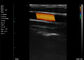 Частота сонной артерии 7.5-10MHz разверток Doppler Handheld цвета отголоска линейная