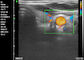 Применение педиатрии Gynecology домашнего ультразвука Doppler ультразвука Doppler портативного диагностического ручного акушерское