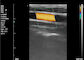 Блока развертки ультразвука машины ультразвука цвета ультразвук домашнего портативный на беременность 8 TGC 3.5~10 MHz