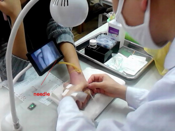 ÐоÑÑаÑивнÑй локаÑÐ¾Ñ Ð²ÐµÐ½Ñ Ð¿ÑибоÑа Venipuncture