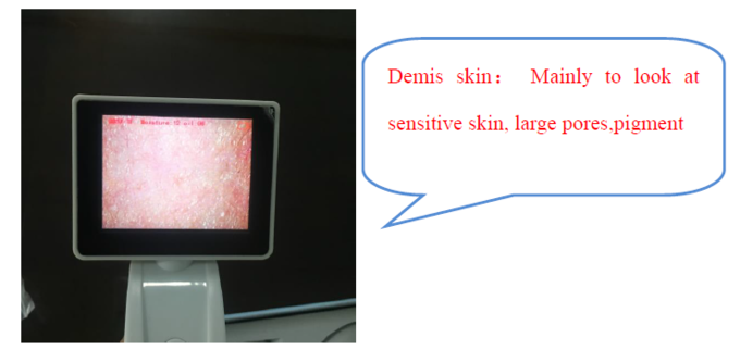Метр влаги кожи цифров анализатора кожи КЭ БС5СХ цифров для доктора