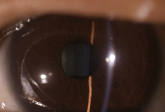 Глаза камеры глаза камеры Fundus 3 цифров оборудования объектива объектив доступного офтальмического поверхностного Anterior меняемый