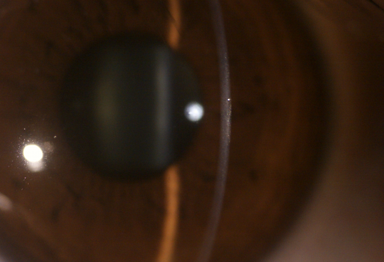 Глаза камеры глаза камеры Fundus 3 цифров оборудования объектива объектив доступного офтальмического поверхностного Anterior меняемый