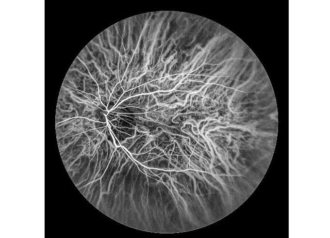 шириной с Ультра оборудование Angiograph цифров сетчатки сканирования лазера поля офтальмическое с оптически сигналом 100°/60°/30°