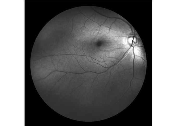 шириной с Ультра оборудование Angiograph цифров сетчатки сканирования лазера поля офтальмическое с оптически сигналом 100°/60°/30°