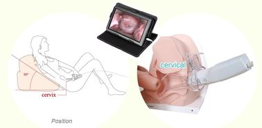 Колпоскопе цифров продукта здравоохранения гинекологический Эндоскопик электронный для женщин самонаводит польза