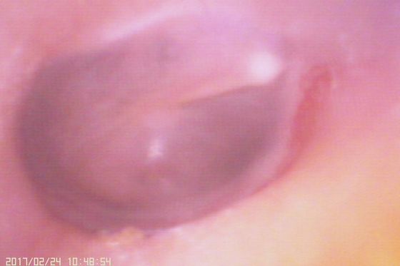 720X480 Цифровой видеоотоскоп