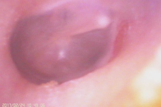 720X480 Цифровой видеоотоскоп