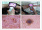 Микроскоп и измерение кожи Усб видео- Дерматоскопе пикселов 1920*1080 Хандхэльд с портом УСБ Вифи опционным