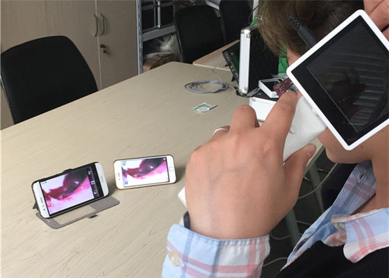 720X480 Цифровой видеоотоскоп