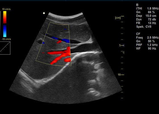 машины Допплер цвета 15 цифров дюйма ультразвук воображения Допплер полной портативный с портом УСБ 2