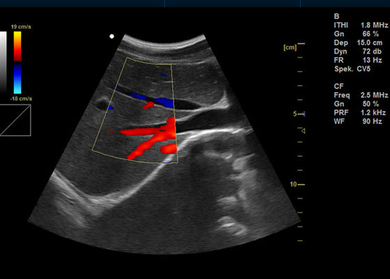 машины Допплер цвета 15 цифров дюйма ультразвук воображения Допплер полной портативный с портом УСБ 2